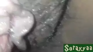 كس شعر جدا